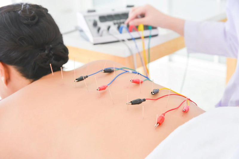 Elektroakupunktur – PointAndFlow Akupunktur Zürich