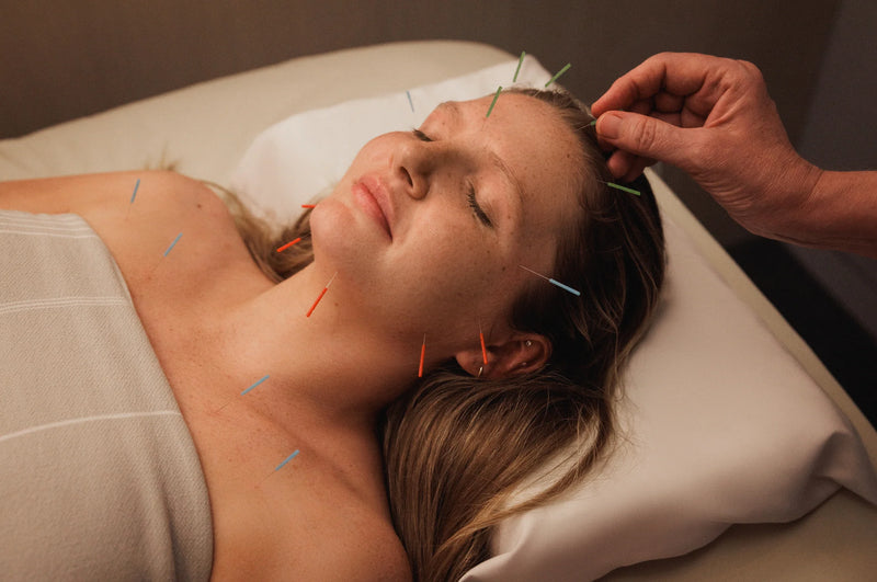 Balancierende Gesichtsakupunktur – Akupunktur Zürich, PointAndFlow Traditional Chinese Medicine